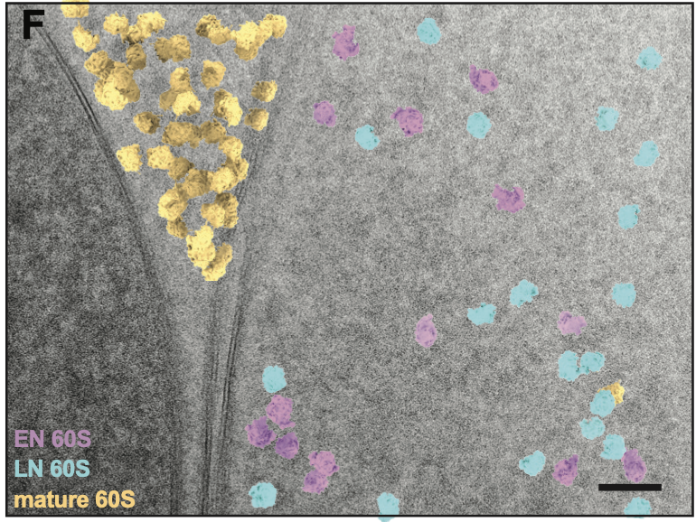 Cellular cryo-EM image with ribosome-like particles mapped back into context